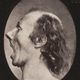 Illustration for article titled Terrifying, Century-Old Photographs from Neuroscience Experiments